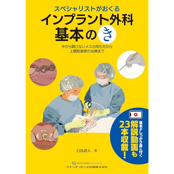 歯科医師のためのインプラント入門: Q&Aで学ぶ絶対必須の“知識”と“実践